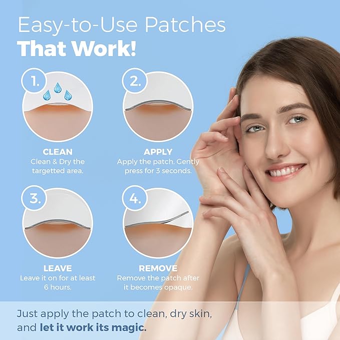 Acne Patches for Face - Hydrocolloid Bandages (108 Count) Pimple Patches for Face in 2 Universal Sizes, Acne Spot Treatment Care for Face & Skin Spot Patch Conceals Zits, Acne and Blackheads
