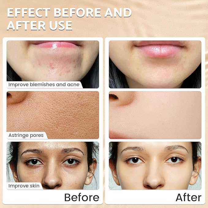 7% Glycolic Acid Exfoliating Toner, Gentle Exfoliating Toner, Smooth Skin, Restores Skin Vitality and Refreshing, Hydrating Formula, Pore Minimizer- 100ml/ 3.38 fl.oz.