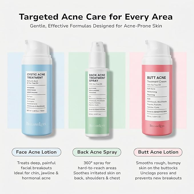 Fungal Acne Treatment Lotion: Helps with Bumps, Clusters, Itch & Redness – Lightweight Anti-Fungal Face & Body Moisturizer for Fungal Skin with Natural Actives & Soothing Plant Extracts