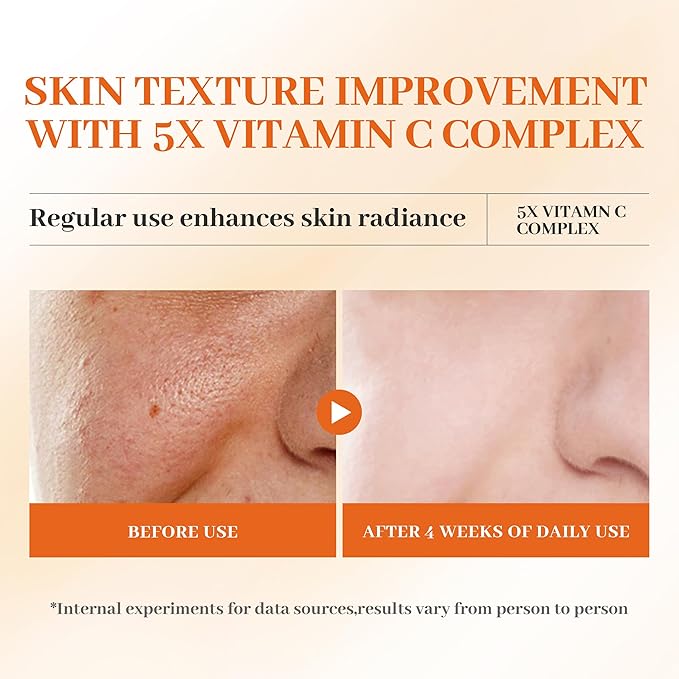 5X Vitamin C Korea 2 Bottles Serum for Face 30ML,HONLINK Hydrating Face Essence,Hyaluronic Acid, Centella For Dull Facial Skin,Uneven Tone,Fine Lines,Pores, Morning & Evening Skincare Women Gift
