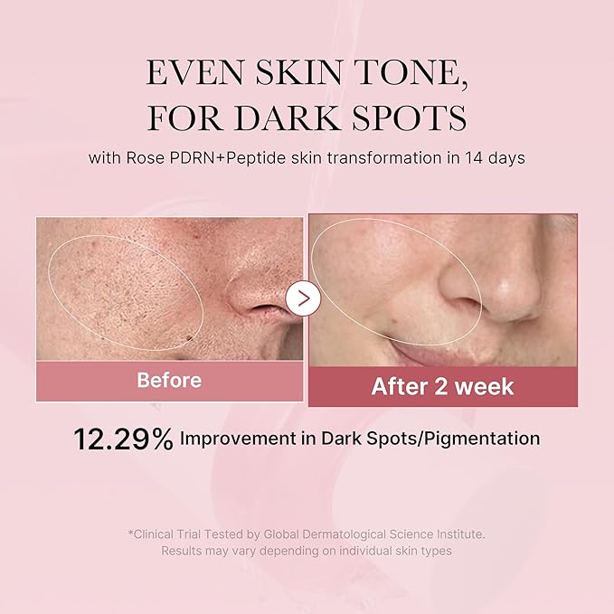 medicube PDRN Toner Rose PDRN Peptide Toner | Lightweight & Watery Type for Skin Boosting, Soothing and Calming, Uneven Skin Tone | with Rose, Peptide, Niacinamide | Korean Skincare, 8.45 fl.oz