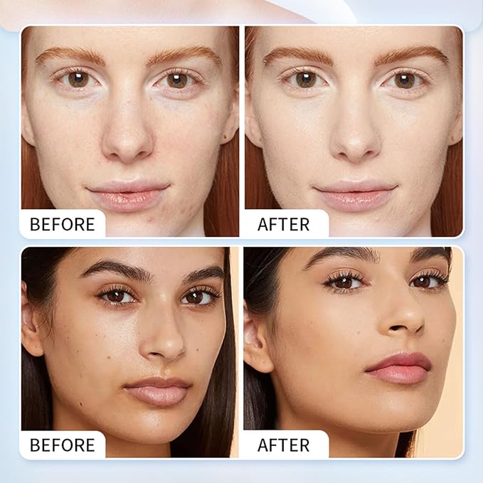 Korean 4-in-1 Super Essence Lotion Moisturizing Face Cream,Hydrating Facial Essence,Women's Facial Toner,Nicotinamide Glossy Serum for all Skins (2pcs)