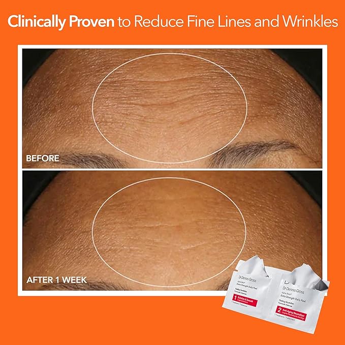 Dr. Dennis Gross Alpha Beta Extra Strength Daily Peel – 2-Step Exfoliating Pads for Enhanced Anti-Aging, Smoother Skin, and Radiant Complexion, 60 Treatments