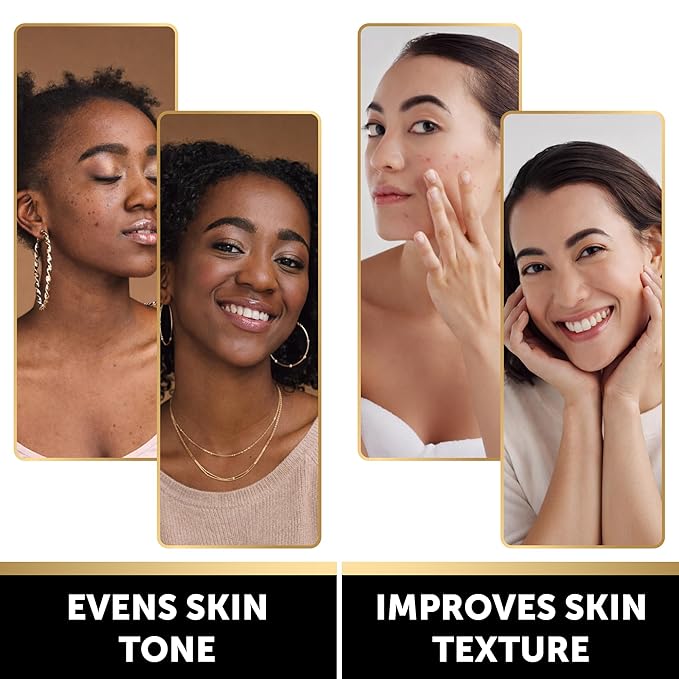 VALITIC Brightening Lemon & Turmeric Kojic Acid Soap with Vitamin C, Retinol, Collagen - Original Japanese Complex - with Hyaluronic Acid, Vitamin E, Shea Butter, Castile Olive Oil 2 Pack+Holder