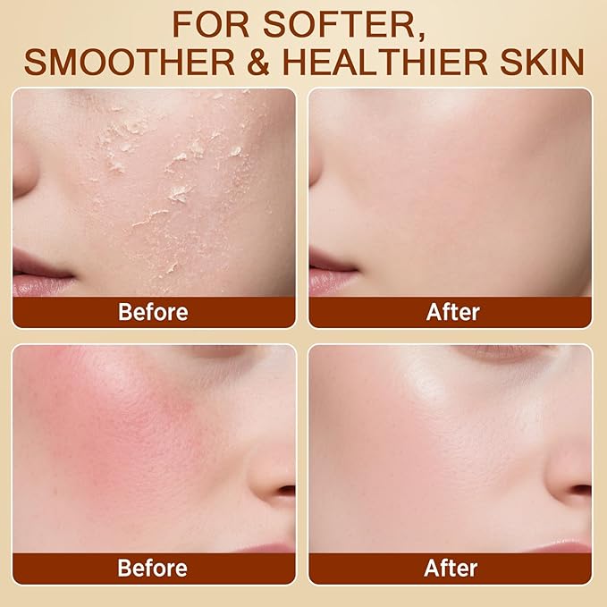 Tallow and Honey Balm for Face, Beef Tallow for Skin, Grass-Fed Beef Tallow & Raw Wild Honey, Body & Face Moisturizer