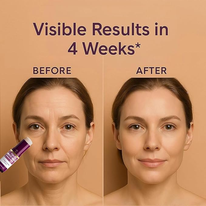 Official Her+ Anti Wrinkle Calcium Balm, Hydrating Face Moisturizer for Eyes,Neck, Face