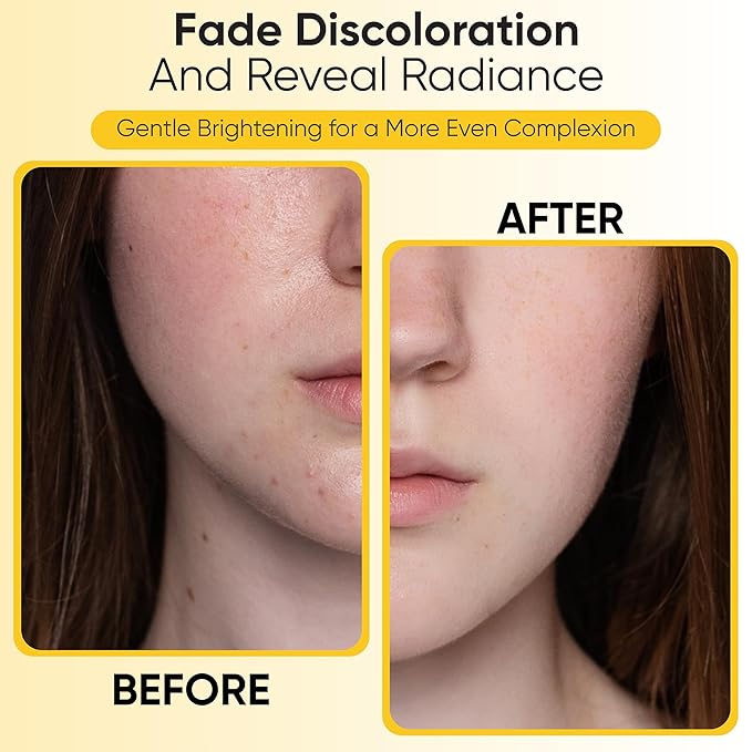Kojic Acid Turmeric Exfoliating Cleansing Pads with Vitamin C in Cotton Pads, Dark Spots Remover & Deep Clean Pores for Face - 50 Pcs.