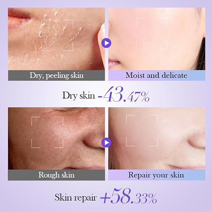 ACSUSS Women's Daily Face Toner - Hydrating Facial Water for Moisturized and Soothed Skin Retinol One Size