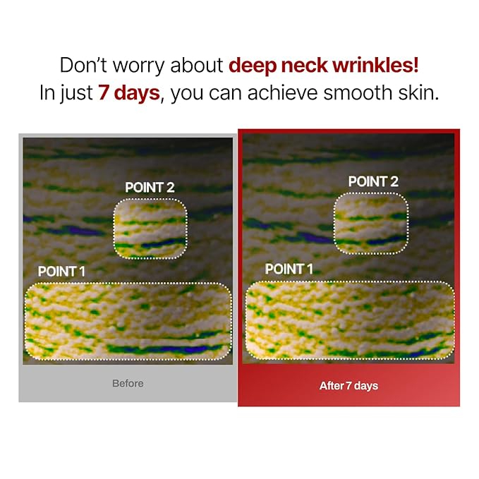 Wrinkle-fit Neck Mask - Neck Wrinkle Patches, Firming and Tightening Korean Deep Collagen Masks - Hyaluronic Acid NeckTargeted Mesh Sheet Mask for Lifting Sagging Skin - Boosting Elasticity 7EA