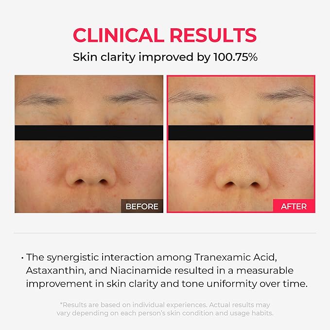 Dr.Melaxin TX Astaxanthin Overnight Wrapping Peel-Off Mask – Skin Tone Improving, Hydrating & Firming Overnight Face Mask for Glow & Texture Refinement