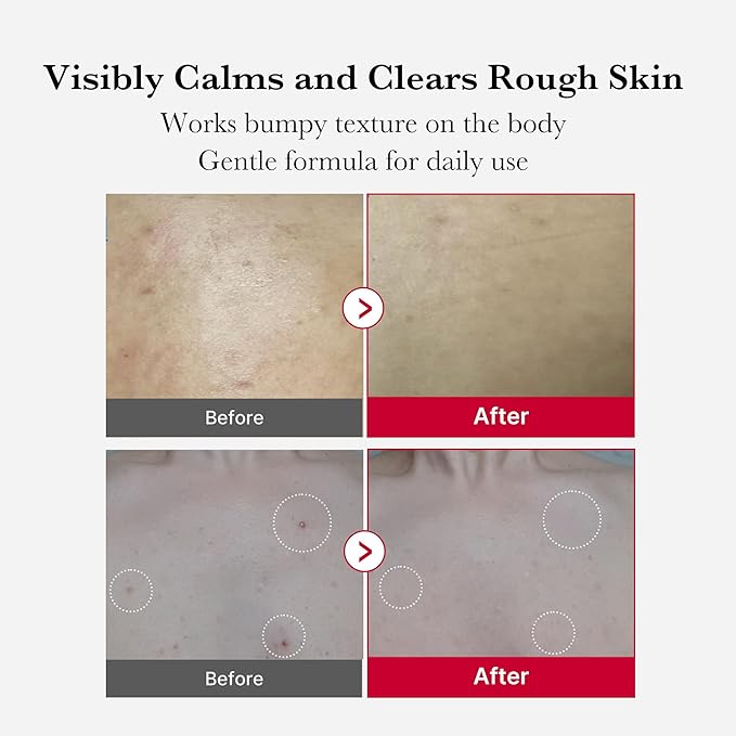 medicube Red Exfoliation & Tone-Care Duo: Red Body Peeling Shot and Red Succinic Acid Panthenol Facial Peeling Pads