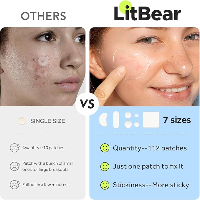 LitBear Large Pimple Patches (7 Sizes 112 Counts), Big Acne Patches, XL Hydrocolloid Bandages for Full Face, Forehead, Chin, Nose, Body, Back, Neck & Chest, Oval, Moon, Square hydrocolloid Patch