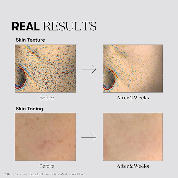 VT COSMETICS TX Toning Facial Toner with Tranexamic Acid, Niacinamide, Glutathione, Hydrating, Refreshing Toner for Dark Spots, Acne Scar, Sun Spots, Age Spots, Korean Skin Care (6.76 fl. oz.)
