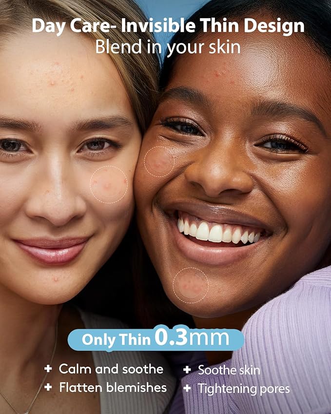 LitBear Acne Pimple Patches- Day and Night 4 Sizes 588 Dots Thin & Thick Hydrocolloid Patches with Witch Hazel, Tea Tree & Calendula Oil, Extra Adhesion for Face Zit Patch Dots