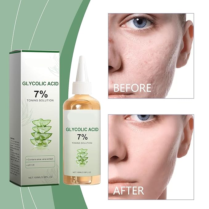 Gentle Hydrating Toner - Moisturizes, Brightens Skin, Removes Impurities, Easy To Use With Foam Sprayer(2PCS)