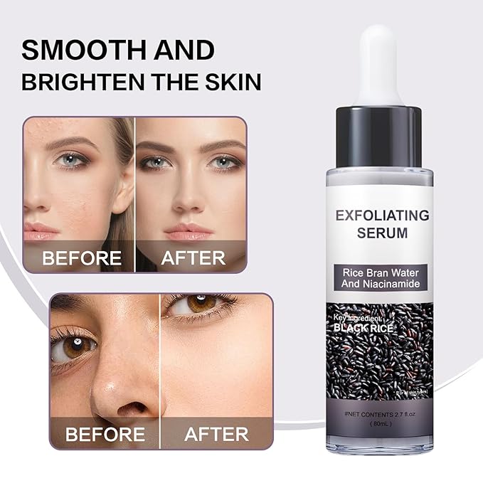 Peel Shot Glow Rice Ampoule Duo – Peel Shot Serums with Black Rice Extract, BHA, Niacinamide & Hyaluronic Acid – Exfoliating, Moisturizing, Blackhead Remover & Pore Refining
