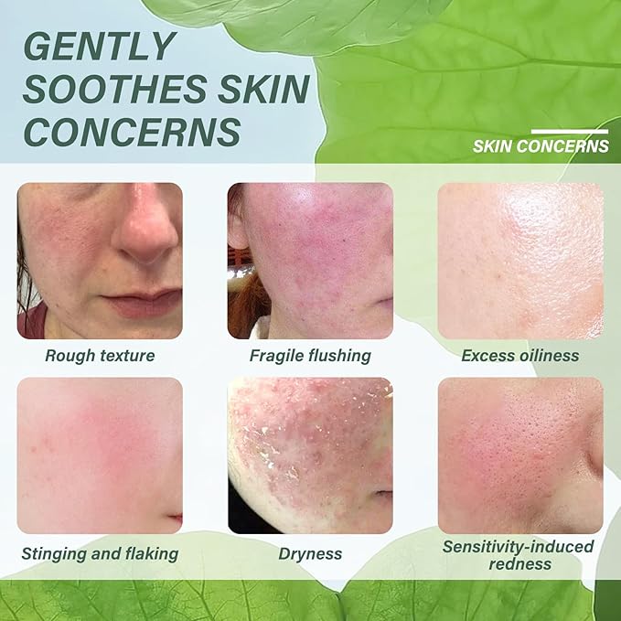 5PCS Centella Face Skin Care Set with Centella Serum,Toner and 3 face masks,Moisturizing Centella Toner Facial Kit,Hydrating Centella Kit Skin Care Gift Set,Nourishing Travel Size Skincare Set