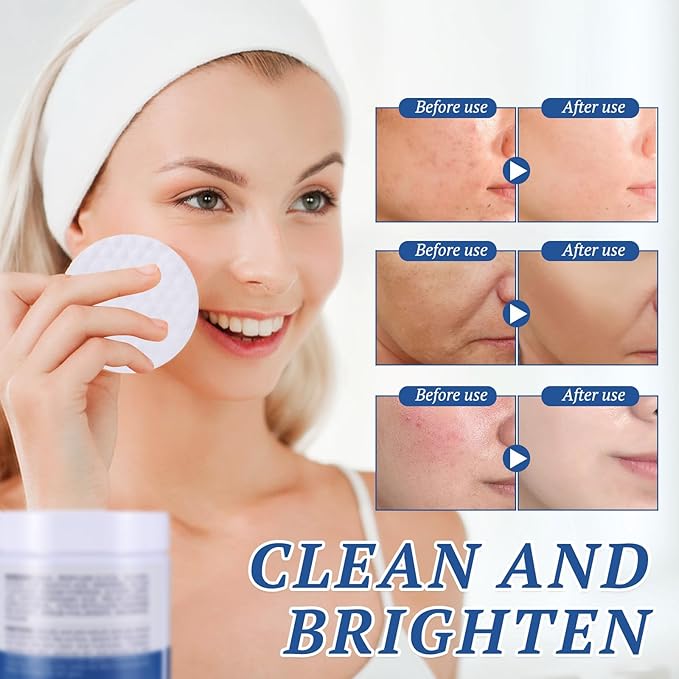 Glycolic Acid Exfoliating Pads 2-Pack, (60 Count x 2) | AHA Face Toner Pads for Acne-Prone & Oily Skin | Unclogs Pores, Smooths Texture