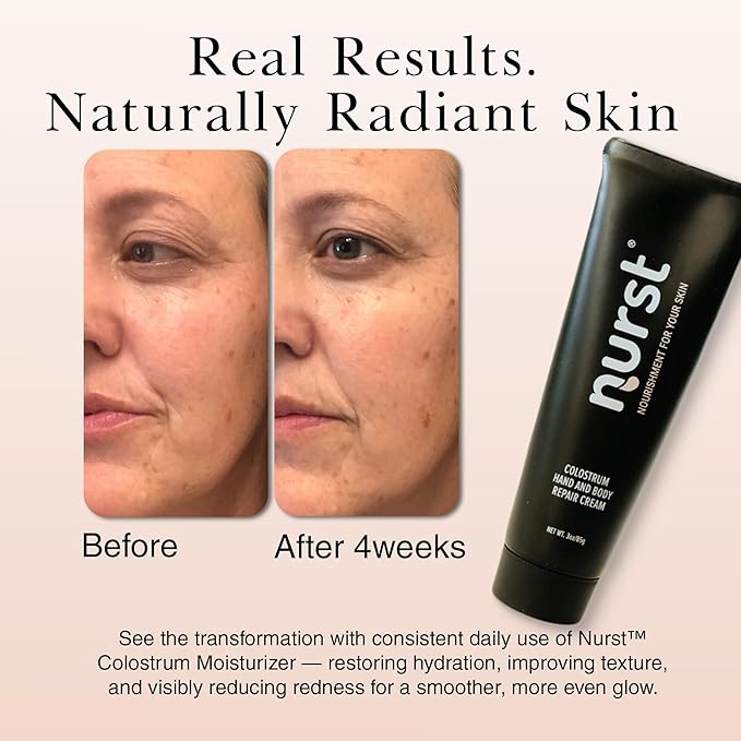Colostrum Daily Face Moisturizer - Lightweight Hydrating Cream with Natural Citrus Scent - Daily Facial Moisturizer for All Skin Types - Niacinamide Hyaluronic Acid