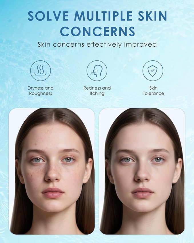 KOMFYMED Hyaluronic Acid Hydrating Sheet Mask – Intensive Moisture & Soothing Facial Mask for Sensitive Skin, Helps Relieve Dryness & Redness with Multi-Weight Hyaluronic Acid & Ectoin (4.4 Oz. /125g)