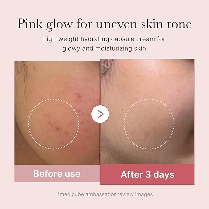 medicube Trending Ingredients Capsule Duo: TXA + Niacinamide and Salmon DNA PDRN Capsule Cream for Clear, Firm, and Hydrated Skin | Customizavble Daily Mositurizer For All Skin Types