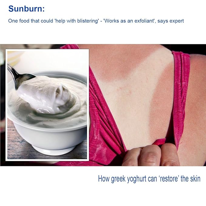 Sunburn Relief Bundle: Aloe First 16.9 fl oz 78,43% Aloe Vera & Bee Propolis + Cooling After Sun Gel w/Real Edible Greek Yogurt 20mL