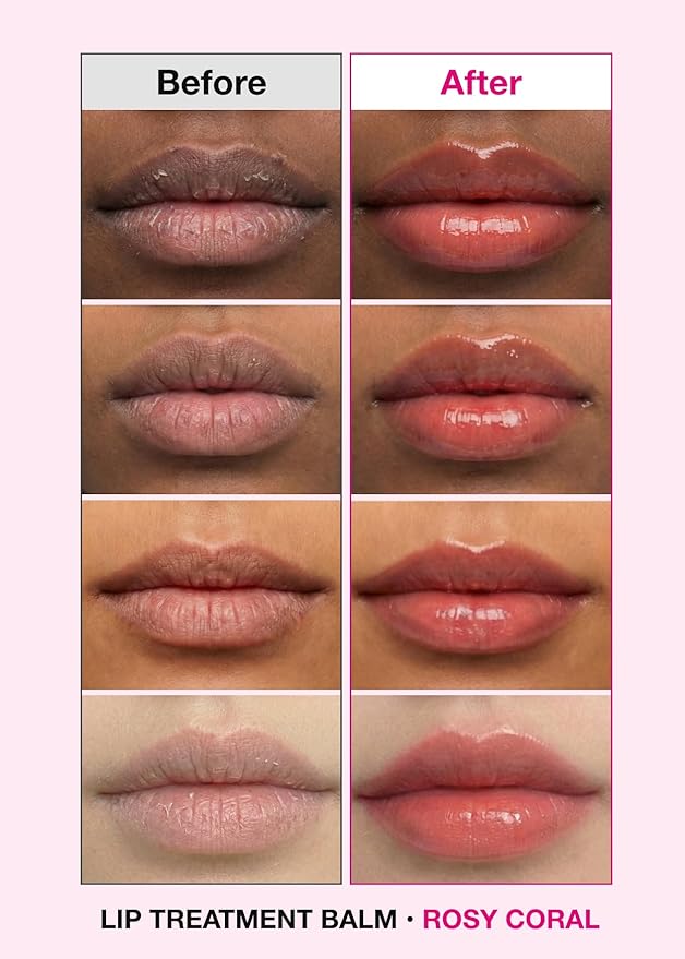 ISOI Bulgarian Rose Lip Treatment Balm (Rosy Coral) – Hydrating & Tinted Lip Balm for Dry Lips, Korean Skincare (0.18 oz, 5g)