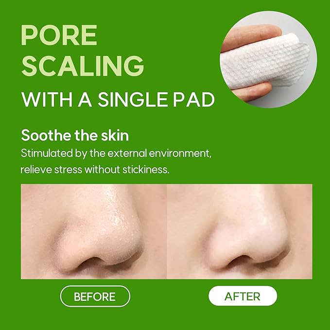 FRUDIA Pore Peeling Pad – 70 Pads, 5.7 fl oz | Vegan Exfoliating Toner Pads with 89% Green Grape Extract, Tannin Complex & Anti‑Sebum P | Gentle, pH‑Balanced Deep Pore Care for Sensitive Oily Skin