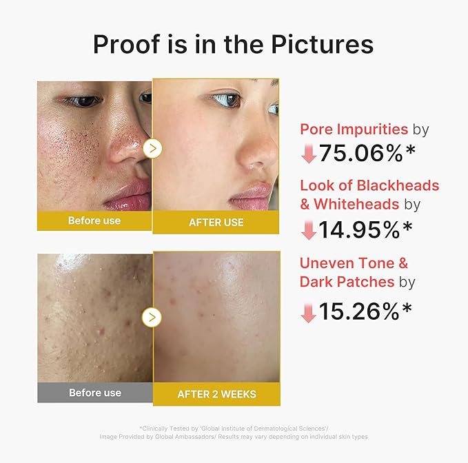 medicube Peel & Wipe Clarifying Duo: Turmeric Peel Shot & Kojic Acid Toner Pads | Gentle Exfoliation & Texture Refining Routine | Ideal for Soothing, Balancing, Smoothing Uneven Skin Tone & Texture
