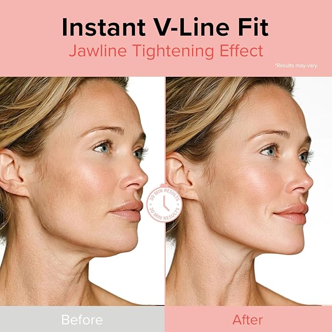 idplacosmetics Face Fit Minus Band V3 (4 Sheets) — Hydrogel Jawline Mask Band for a Contoured, Lifted-Looking V-Line, Collagen, Elastin & Multi-Peptide Complex + Multi-Weight Hyaluronic Acid