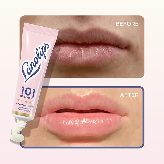 Lanolips 101 Multipurpose Ointment Duo - Lanolin Lip Balm & Healing Ointment for Skin Barrier Repair - Moisturizer for Dry Lips, Cuticles & Elbows - Original Superbalm (2-Pack, 0.52 oz each)