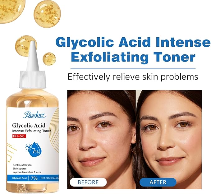 7% Glycolic Exfoliating Acid Toner, Even Skin Tone, Smooth Skin, Unclogs Pores, Gentle Effective Toner with Hydrating Properties for Daily Use