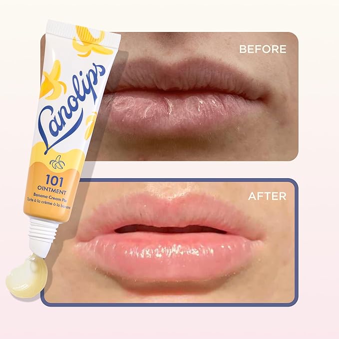 Lanolips 101 Ointment - Lanolin Lip Balm for Smooth, Hydrated & Healthy Lips - Multipurpose Ointment with Lanolin Oil for Dry Cuticles & More - Banana Cream Pie (0.35 oz)