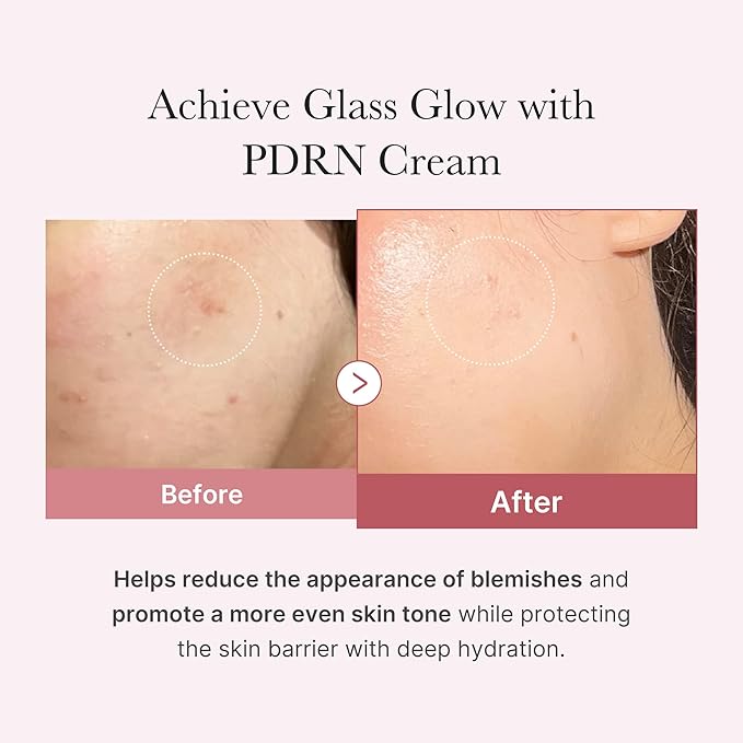medicube Salmon DNA PDRN Pink Hyaluronic Moisturizing Cream | Blemish Relief & Hydrating Care | Restores Skin Elasticity & Glow | Korean Skincare, Even Skin Tone & Pore Care | 50ml / 1.69 fl.oz.