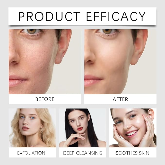 Glycolic Acid Exfoliating Toner for Face, Exfoliant for Oily & Combination Skin, Gently Removes Dead Cells, Refines Pores for Smoother Texture & a Refreshed, Healthy-Looking Glow (2)