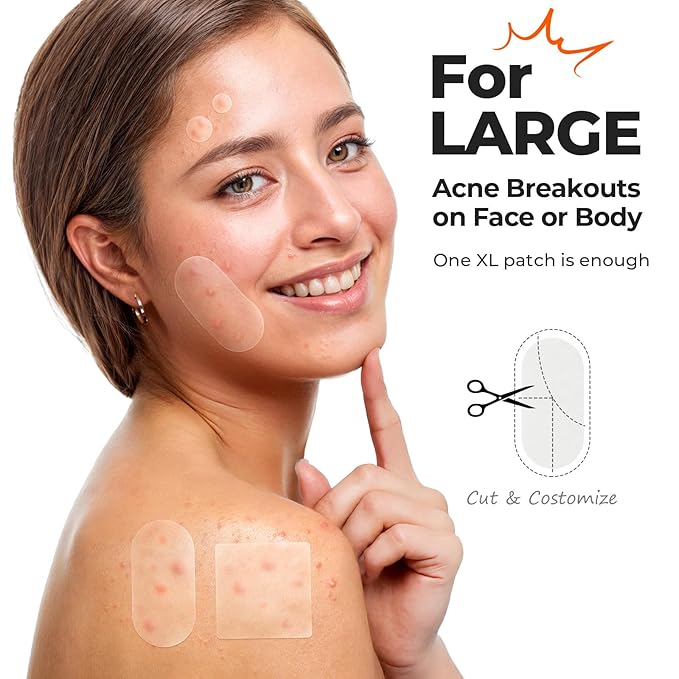 TKTK Large Pimple Patches for Face, 60 x 30 mm XL Acne Patches, Big Hydrocolloid Bandages for Body, Back, Forehead, Chin, Neck Blemish Zit Breakouts (Oval, Square, Dot 5 Sizes 265 Count)
