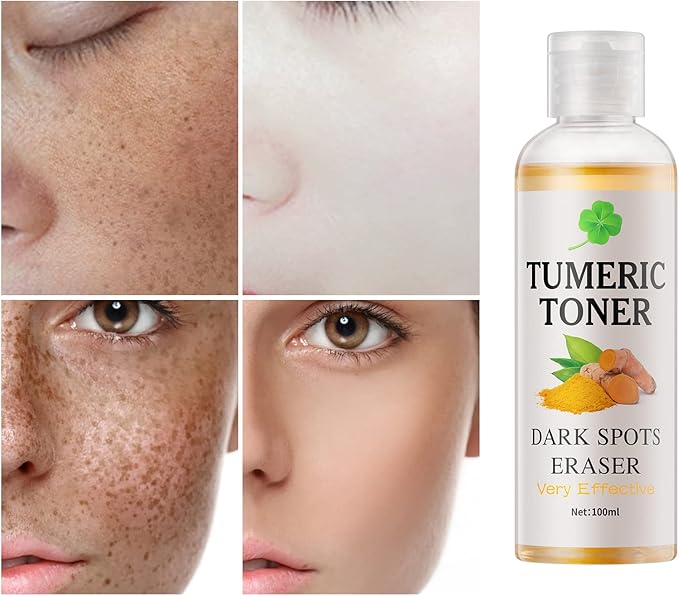 Toner for Dark Spots Turmeric Dark Spot Corrector, Facial Toner for Acne Prone Skin, Dark Spot Correcting Hydrating Face Toner for Women Moisturizing for All Skin Type- 3.4 OZ