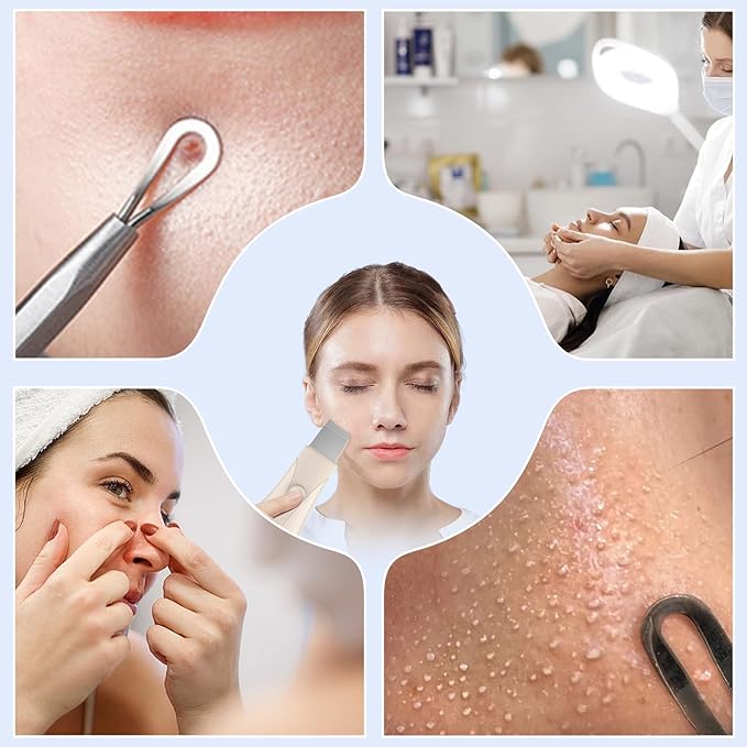 Skin Scrubber Face Spatula Skin Spatula Pore Cleaner Blackhead Remover Tools for Facial Deep Cleansing Skin Care Tool for Men and Women (Beige)