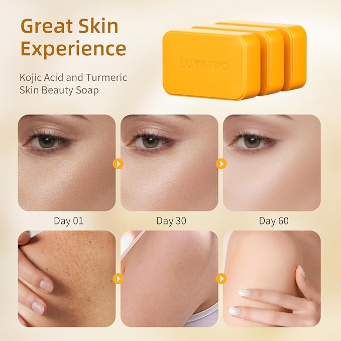 Kojic Acid Turmeric Soap Bar 3 Pack for Body & Face, Made with Natural and Organic Ingredients. Gentle Soap, For All Skin Types