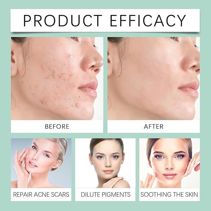 Gentle Facial Toner - Fades Acne & Closed Comedones, Cleans Impurities, Nourishes & Repairs Facial Skin(2PCS)