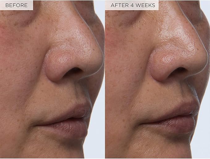 Glow Recipe Toner Duo - Glow Recipe PHA+BHA Pore Minimizer & Facial Exfoliator for Glass Skin - Tightening & Hydrating Skincare with Hyaluronic Acid (150 ml & 40 ml)