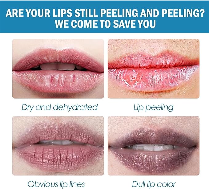 2PCS Lip Lightening for Dark Lips Lip for Smokers Dark Lip Treatment Lightening Cream for Pink Lips Lip Lightener for Smoker Lips Lip Lightening balm for Men and Women (Red)