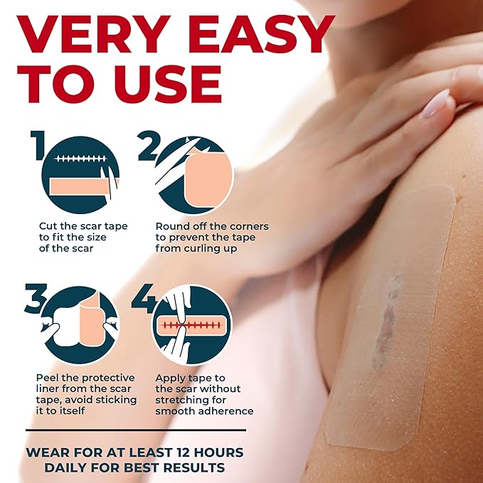 Medical Grade Silicone Scar Tape - 1.6”x60” - Visible Difference on Surgical & Keloid Scars - Reusable Silicone Scar Sheets - Easy to Use Silicone Tape for Scars