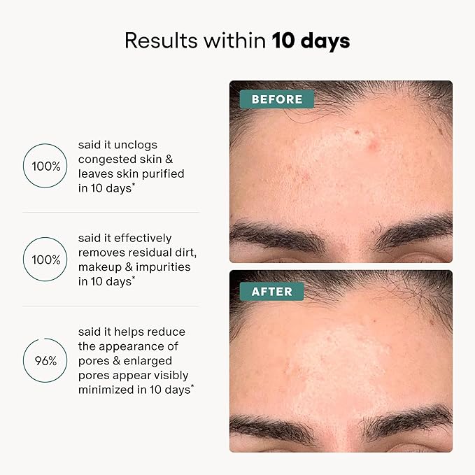 Algenist Genius Liquid Skin Resurfacing Face Toner - Gentle 2% BHA Liquid Exfoliant with Salicylic Acid & Collagen - Minimizes Pores, Firms & Smooths Fine Lines - Vegan Anti Aging Skin Care (3.4 oz)