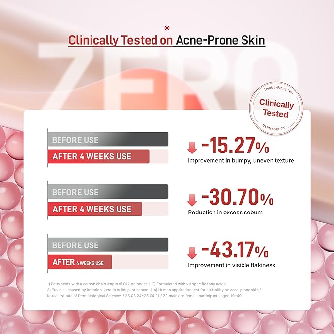 Zeroca 86 Toner - Korean Wild Rose Water for Acne-Prone & Sensitive Skin – Fast Calming & Soothing for Breakout Relief – Calms Redness & Supports Clear Skin,6.76 oz. 200ml