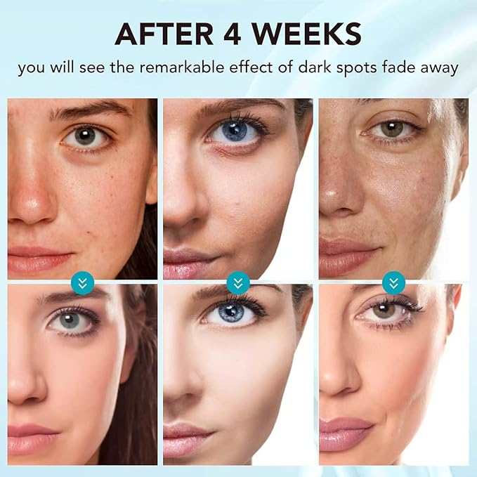 Skin Care - Skin Lightening & Bleaching Cream, Face Moisturizer with Vitamin C & Arbutin, Dark Spot Remover for Body & Intimate Areas, Underarm, Knees, Elbows, Inner Thigh, Private Parts- 1.7 Fl Oz