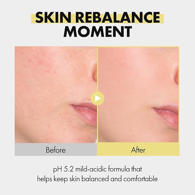 The First Rosemary Serum - 4-in-1 Hydrating, Nourishing, Soothing and Exfoliating Face Serum - Lightweight and Non-Sticky Korean Skin Care for Fine Lines and Uneven Skin Tone 6.08 Fl Oz
