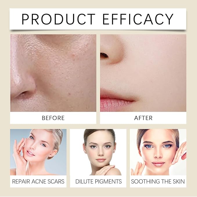 Moisturizing Soothing Toner, Houttuynia cordata Facial Toner soothes Skin and rejuvenates it