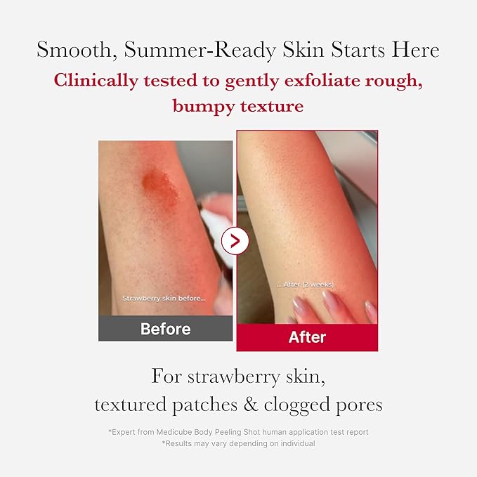 medicube Ultimate Red Spray Duo to Smooth & Soothe: Power Soothing Spray and Red Body Peeling Shot