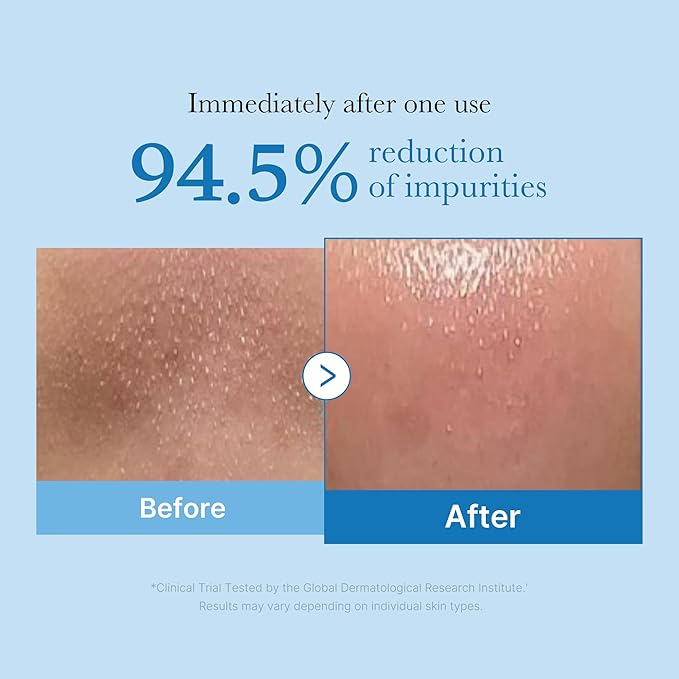 medicube Pore Care Duo for Flawless Skin: Zero Pore Blackhead Cleansing Oil and Zero Pore Pads 2.0 for Smoother, Refined Skin | Cleanse and Prep for Glass Glow Skin | Korean Skincare